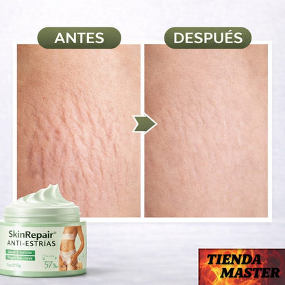 CREMA ANTIESTRIAS 4 EN 1